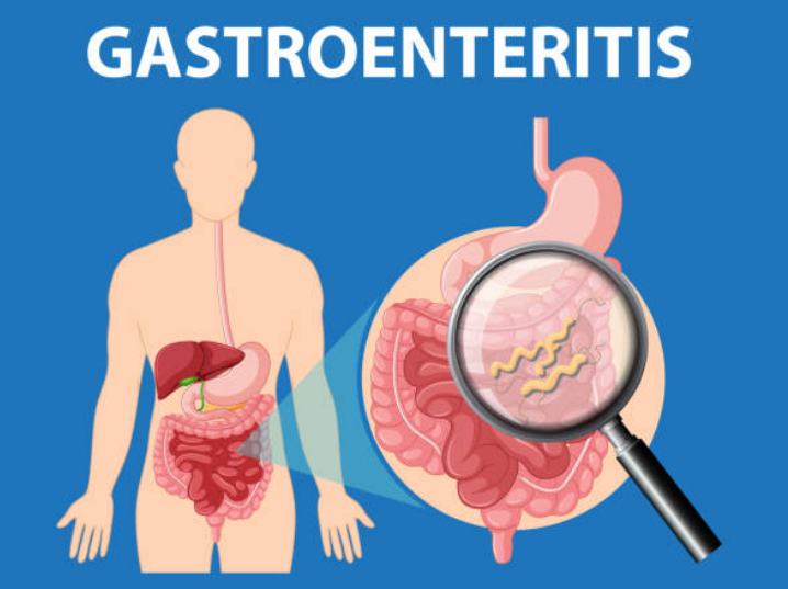 اعراض النزلة المعوية
