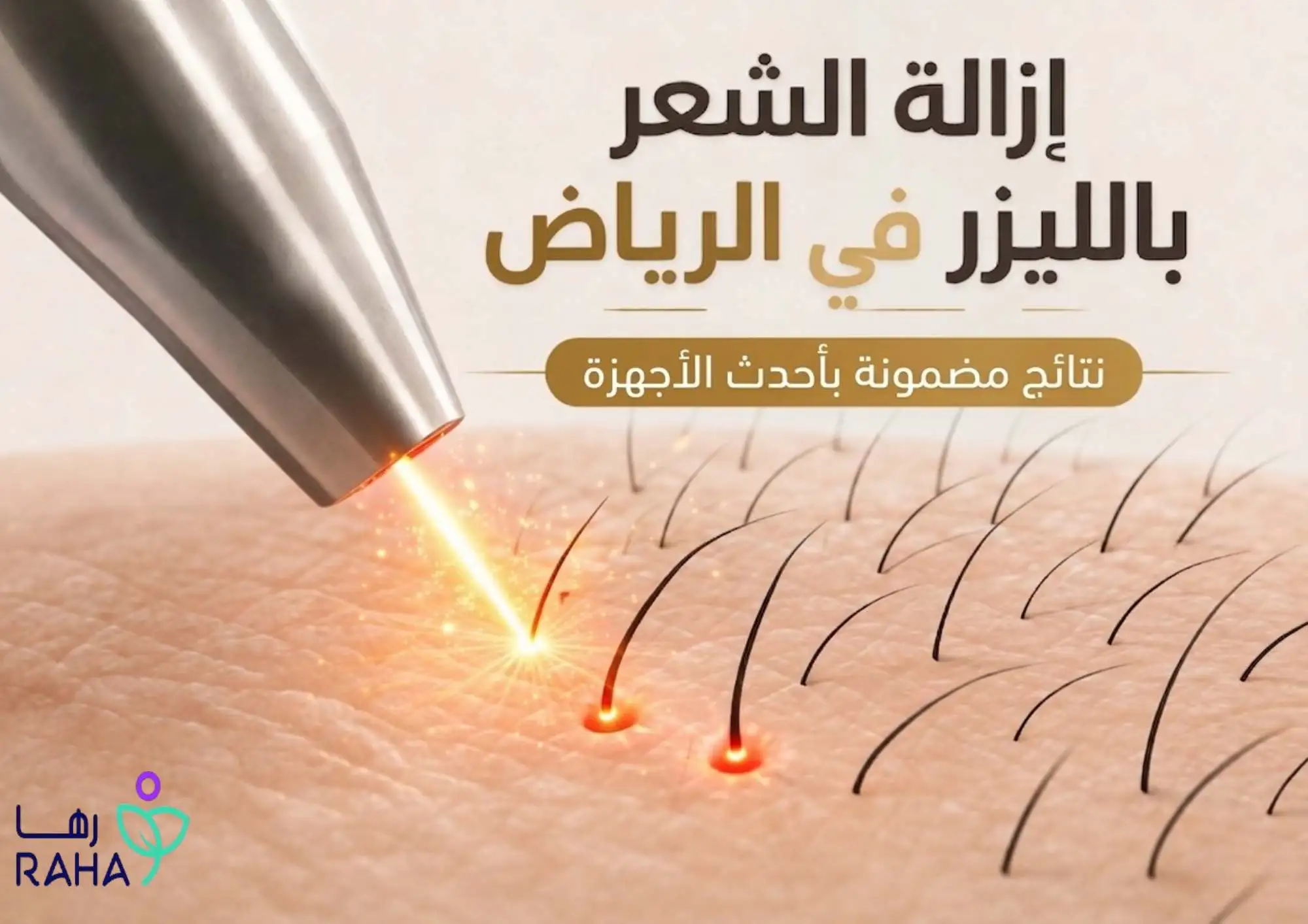 إزالة الشعر بالليزر في الرياض | نتائج مضمونة بأحدث الأجهزة