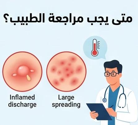 متى يجب مراجعة الطبيب؟