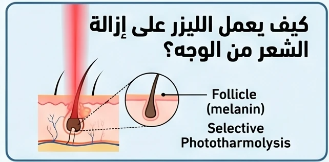 كيف يعمل الليزر على إزالة الشعر من الوجه؟
