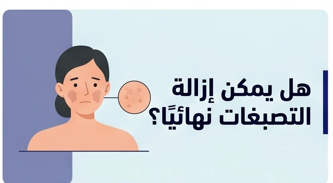 هل يمكن إزالة التصبغات نهائيًا؟