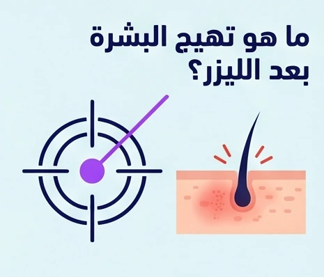 ما هو تهيج البشرة بعد الليزر؟