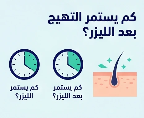 كم يستمر التهيج بعد الليزر؟