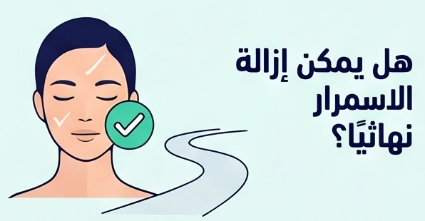 هل يمكن إزالة الاسمرار نهائيًا؟