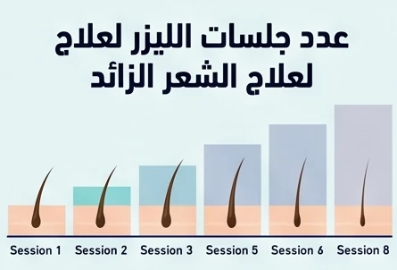 عدد جلسات الليزر لعلاج الشعر الزائد