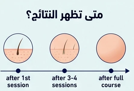 متى تظهر النتائج؟