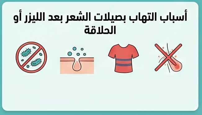 أسباب التهاب بصيلات الشعر بعد الليزر أو الحلاقة