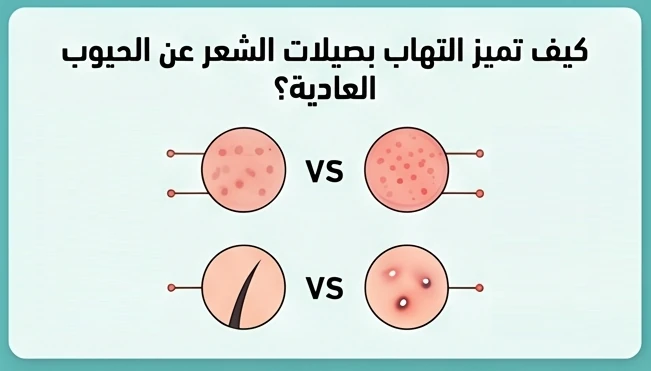 كيف تميز التهاب بصيلات الشعر عن الحبوب العادية؟