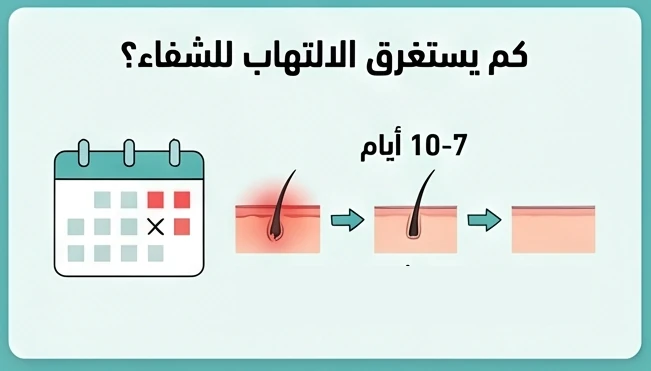 كم يستغرق الالتهاب للشفاء؟