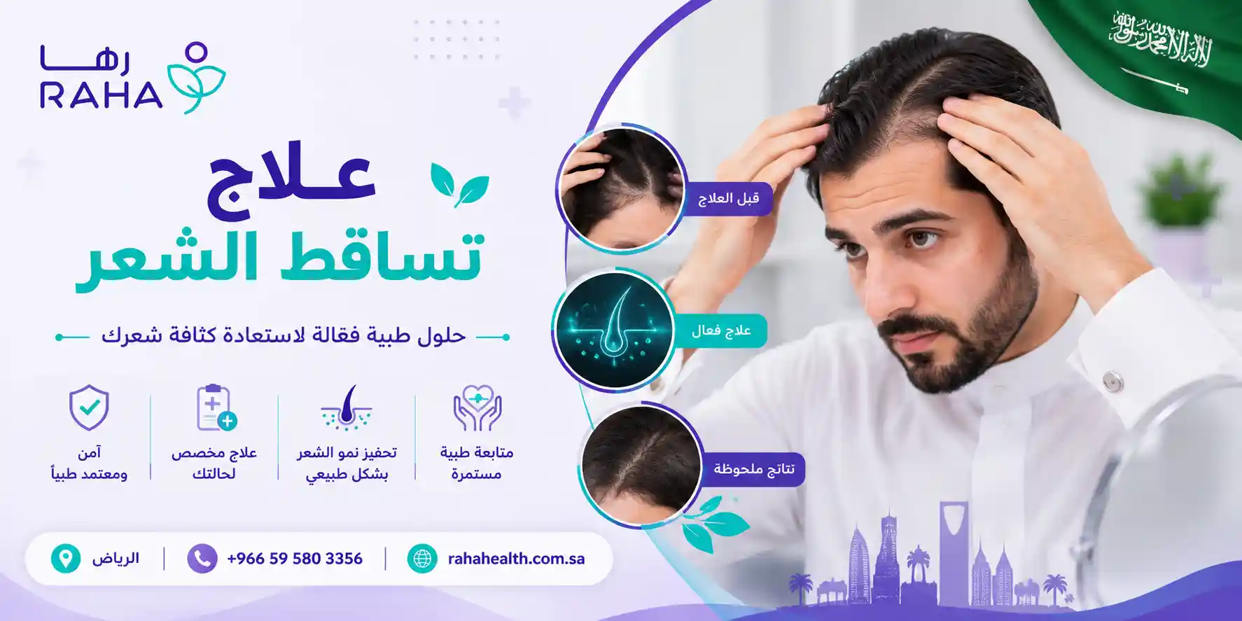 علاج تساقط الشعر | الأسباب وأفضل طرق استعادة الكثافة