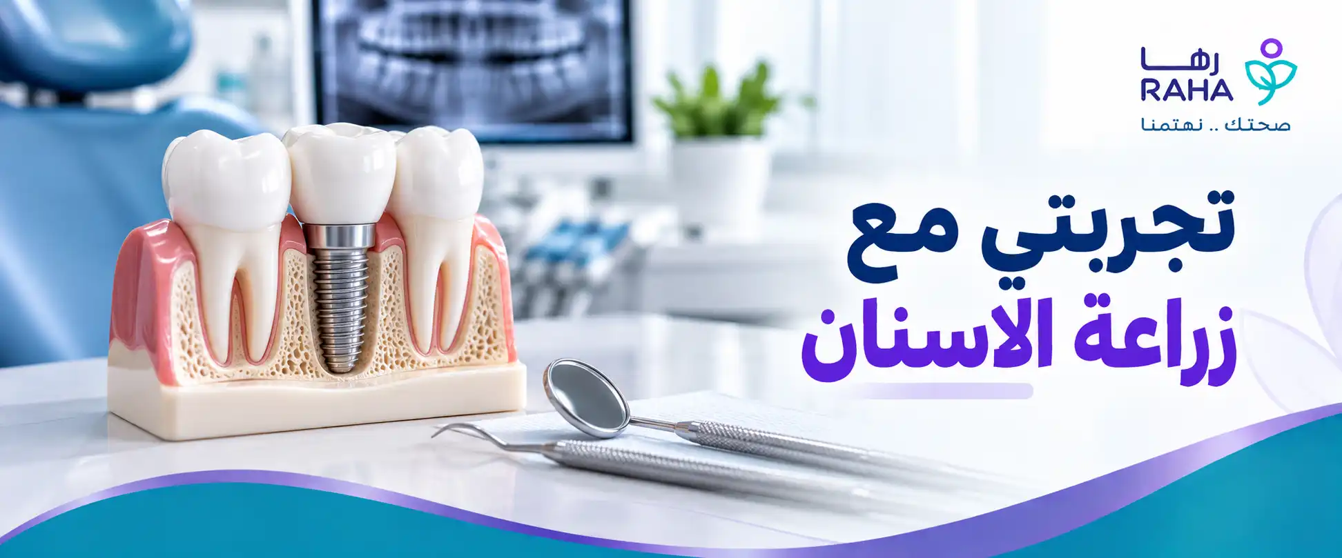 تجربتي مع زراعة الاسنان من الاستشارة حتى الابتسامة الجديدة