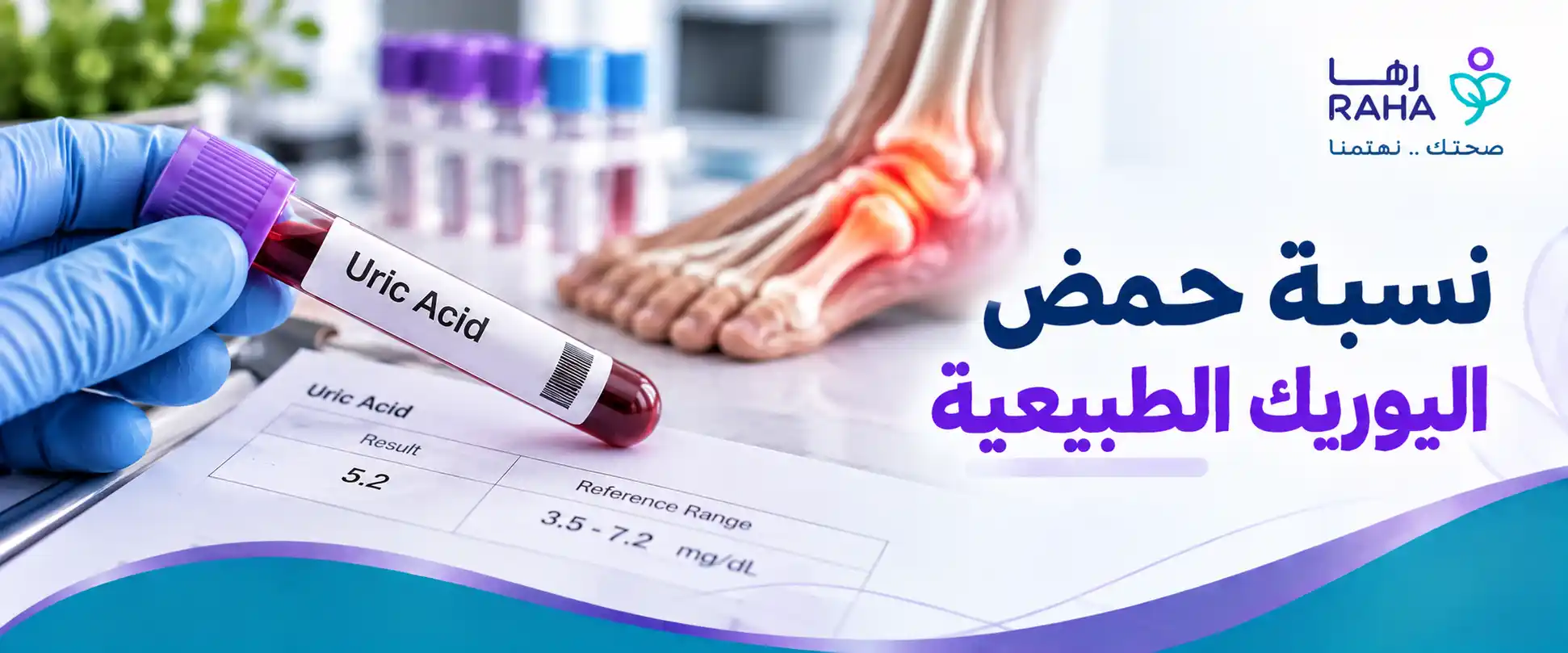 نسبة حمض اليوريك الطبيعية في الدم ومتى تصبح مرتفعة